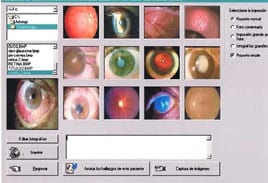 Endovista , Software Oftalmico para captura de imagenes y control de pacientes-0