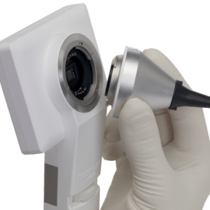Lente para Otoscopia de camara multidiciplinaria Horus-0