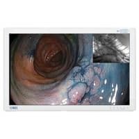 90R0070 Pantalla LCD de 42" grado medico Radiance Alta definicion-0