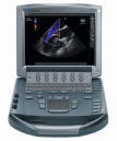 M-TURBO SONOSITE Equipo de Ultrasonido Médico portatil USADO-0