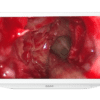 LMD2735MD Sony 27" Medical Monitor Análogo & Digital HD ntsc para cirugía de mínima invasión y quirófano y consultorio-3682