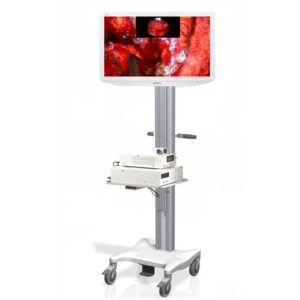 Set Sony de video con pedestal rodable panatlla grado medico ful HD grabador de video incluye:-0