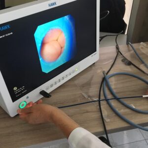 Tele Pack Hawk para video Endoscopia full HD 24"