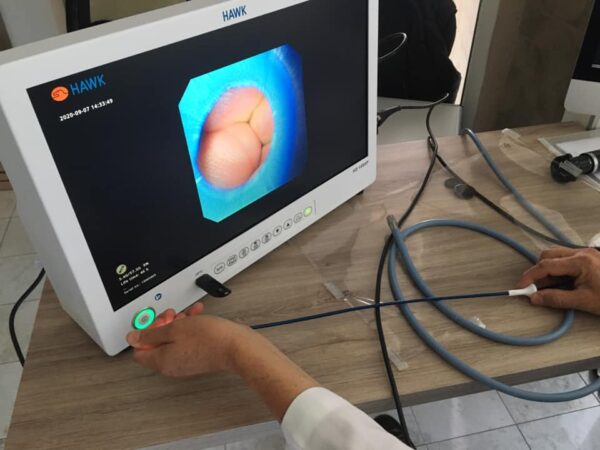 Tele Pack Hawk para video Endoscopia full HD 24"