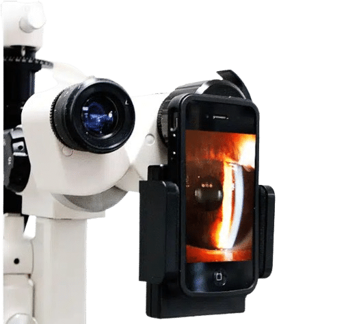 Adaptador de celular a Lampara de Hendidura, Microscopio 1 Adaptador de celular a Lampara de Hendidura, Microscopio