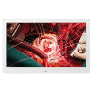 Monitor Quirúrgico LG de 27" Full HD 1080P IPS