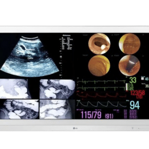 Monitor quirúrgico LG de 31,5" 4K IPS