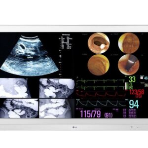 Monitor quirúrgico LG 32HL714S-W de 31,5 pulgadas 4K IPS