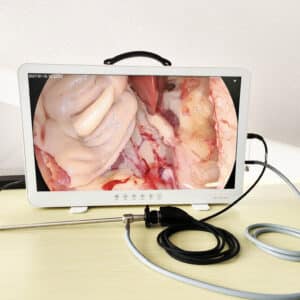 Tele pack HD 27" cámara Endoscópica, fuente de Luz LED y pantalla