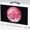 Tele pack HD 27" cámara Endoscópica, fuente de Luz LED y pantalla - Image 3