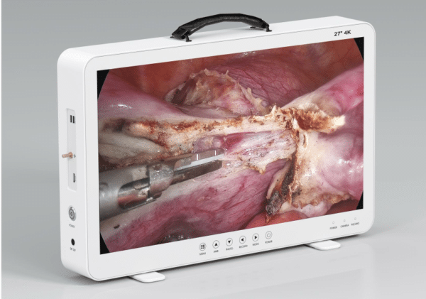 Telepack 4K 27" monitor con endo cámara y fuente de Luz