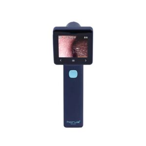 Otoscopio digital Ezer EZ-Horus OTO blue