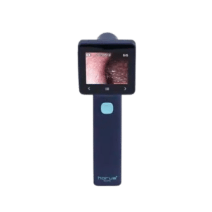 Otoscopio digital Ezer EZ-Horus OTO blue