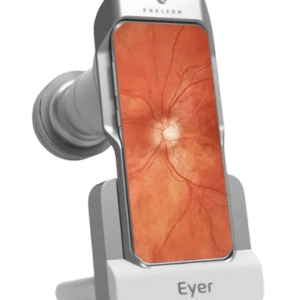 EYER NM Top Video Oftalmoscopio