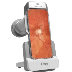 EYER NM Top Video Oftalmoscopio