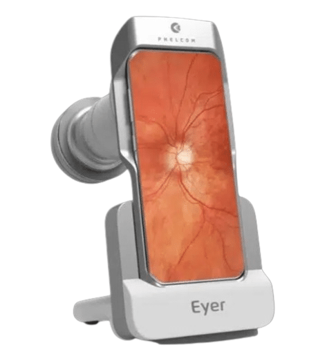 EYER NM Top Video Oftalmoscopio