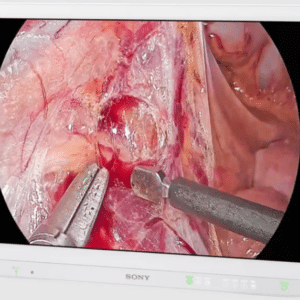 Mini Led Surgical Display Dual Sony 27" 4K, LMD27M1MD/A, Los colores mas esquisitos en cirugia